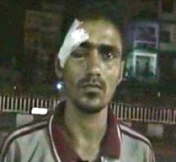 Noida teacher hit with iron rod allegedly by student he had caught cheating